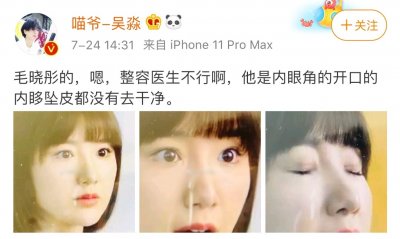 baby前化妆师内涵毛晓彤整容?直言其手术太失败