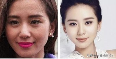 在高清镜头下,有一种“尴尬”叫卡粉